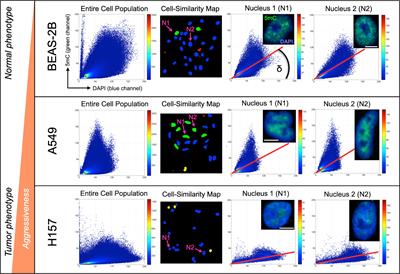 DNA methylation topology differentiates between normal and malignant in cell models, resected human tissues, and exfoliated sputum cells of lung epithelium
